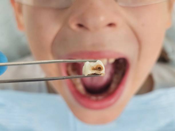 Best Emergency Dental Services for Seniors in Port Barrington, IL